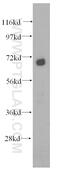 Decapping MRNA 1B antibody, 13863-1-AP, Proteintech Group, Western Blot image 