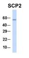 CTD Small Phosphatase 2 antibody, orb330861, Biorbyt, Western Blot image 