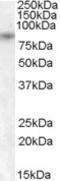 Transient Receptor Potential Cation Channel Subfamily V Member 5 antibody, EB08515, Everest Biotech, Western Blot image 