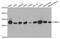 Proteasome Subunit Alpha 4 antibody, TA332532, Origene, Western Blot image 