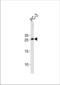 Homeobox C6 antibody, TA324802, Origene, Western Blot image 