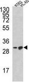 BCL2 Like 11 antibody, GTX81177, GeneTex, Western Blot image 