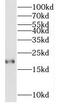 Myosin regulatory light chain 2, atrial isoform antibody, FNab05490, FineTest, Western Blot image 