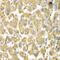 Mitogen-Activated Protein Kinase Kinase Kinase Kinase 3 antibody, 22-884, ProSci, Immunohistochemistry paraffin image 