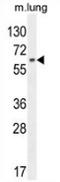 Nuclear factor erythroid 2-related factor 1 antibody, AP52860PU-N, Origene, Western Blot image 