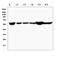 Polypyrimidine Tract Binding Protein 1 antibody, A01798, Boster Biological Technology, Western Blot image 