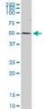 Ubiquitin Specific Peptidase 3 antibody, H00009960-D01P, Novus Biologicals, Western Blot image 