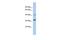 ADP Ribosylation Factor Like GTPase 14 Effector Protein antibody, GTX45679, GeneTex, Western Blot image 