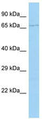 Cytochrome P450 Family 4 Subfamily F Member 22 antibody, TA331598, Origene, Western Blot image 