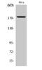 Erbb2 Interacting Protein antibody, A06036Y1104, Boster Biological Technology, Western Blot image 
