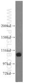 Signal Transducer And Activator Of Transcription 6 antibody, 51073-1-AP, Proteintech Group, Western Blot image 