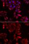 PDZ And LIM Domain 1 antibody, GTX33399, GeneTex, Immunofluorescence image 