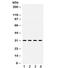 Insulin Like Growth Factor Binding Protein 3 antibody, R31990, NSJ Bioreagents, Western Blot image 