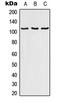 RAB3 GTPase Activating Protein Catalytic Subunit 1 antibody, LS-C353322, Lifespan Biosciences, Western Blot image 