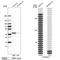 Cysteine And Histidine Rich Domain Containing 1 antibody, NBP1-85629, Novus Biologicals, Western Blot image 