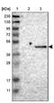 ST3 Beta-Galactoside Alpha-2,3-Sialyltransferase 2 antibody, NBP1-87044, Novus Biologicals, Western Blot image 