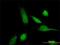 ATP Binding Cassette Subfamily C Member 11 antibody, H00085320-M02, Novus Biologicals, Immunocytochemistry image 