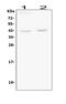 BMI1 Proto-Oncogene, Polycomb Ring Finger antibody, PB9133, Boster Biological Technology, Western Blot image 