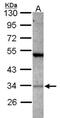 Protein Activator Of Interferon Induced Protein Kinase EIF2AK2 antibody, NBP2-19674, Novus Biologicals, Western Blot image 