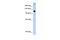 SWI/SNF Related, Matrix Associated, Actin Dependent Regulator Of Chromatin, Subfamily A, Member 5 antibody, PA5-40312, Invitrogen Antibodies, Western Blot image 