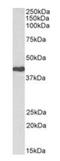 Cyclin Dependent Kinase 7 antibody, orb247031, Biorbyt, Western Blot image 