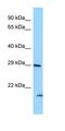 Syntrophin Beta 2 antibody, orb326452, Biorbyt, Western Blot image 