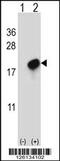 CKLF Like MARVEL Transmembrane Domain Containing 7 antibody, 61-759, ProSci, Western Blot image 