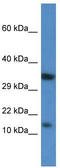 CAMP-Dependent Protein Kinase Inhibitor Beta antibody, TA344652, Origene, Western Blot image 