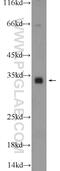 Transmembrane Protein 241 antibody, 25499-1-AP, Proteintech Group, Western Blot image 