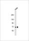 Ubiquitin Specific Peptidase 2 antibody, 61-094, ProSci, Western Blot image 