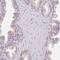 Hexosaminidase Subunit Beta antibody, NBP2-49211, Novus Biologicals, Immunohistochemistry frozen image 