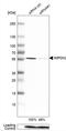 Inosine Monophosphate Dehydrogenase 2 antibody, NBP1-86177, Novus Biologicals, Western Blot image 