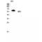 Receptor Interacting Serine/Threonine Kinase 2 antibody, LS-C385930, Lifespan Biosciences, Western Blot image 
