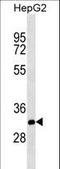 THAP Domain Containing 11 antibody, LS-C161843, Lifespan Biosciences, Western Blot image 