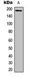 Insulin Receptor Substrate 1 antibody, orb256631, Biorbyt, Western Blot image 