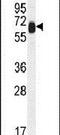 Tetratricopeptide Repeat Domain 39B antibody, PA5-24497, Invitrogen Antibodies, Western Blot image 