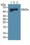 Fibrinogen Beta Chain antibody, LS-C294153, Lifespan Biosciences, Western Blot image 