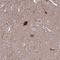 Centrosomal Protein 41 antibody, HPA024090, Atlas Antibodies, Immunohistochemistry paraffin image 