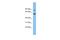 VPS52 Subunit Of GARP Complex antibody, A06884, Boster Biological Technology, Western Blot image 