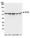 RNA 2',3'-Cyclic Phosphate And 5'-OH Ligase antibody, A305-078A, Bethyl Labs, Western Blot image 