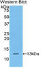 S100 Calcium Binding Protein A10 antibody, LS-C297674, Lifespan Biosciences, Western Blot image 