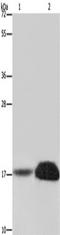 Fragile Histidine Triad Diadenosine Triphosphatase antibody, TA349983, Origene, Western Blot image 