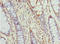 Chaperonin Containing TCP1 Subunit 5 antibody, LS-C675475, Lifespan Biosciences, Immunohistochemistry paraffin image 