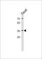 FOS Like 2, AP-1 Transcription Factor Subunit antibody, MBS9211707, MyBioSource, Western Blot image 