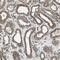 RAB7A, Member RAS Oncogene Family antibody, PA5-52369, Invitrogen Antibodies, Immunohistochemistry paraffin image 