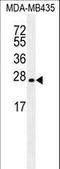 Lin-28 Homolog A antibody, LS-C203674, Lifespan Biosciences, Western Blot image 