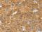 SLIT-ROBO Rho GTPase Activating Protein 2 antibody, MBS2526249, MyBioSource, Immunohistochemistry paraffin image 