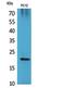 Vascular Endothelial Growth Factor B antibody, STJ96851, St John