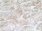 Cyclin Dependent Kinase 6 antibody, 19117-1-AP, Proteintech Group, Immunohistochemistry frozen image 