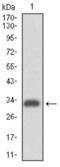 CD49D antibody, abx011677, Abbexa, Western Blot image 